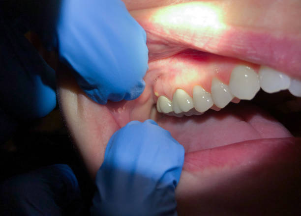 Best Emergency TMJ Treatment in Sands Point, NY