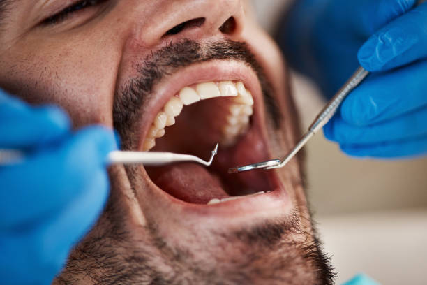 Best Pediatric Emergency Dentist in Sands Point, NY